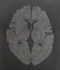 MRI摜2014N