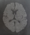 MRI摜2015N