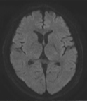 MRI摜2016N1
