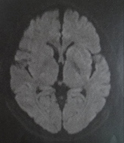 MRI画像2016年2